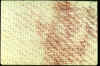 Shroud of Turin | Blood Stains