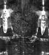 Shroud of Turin | Jesus' back - negative
