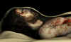 Jesus' body wrapped within the Shroud of Turin